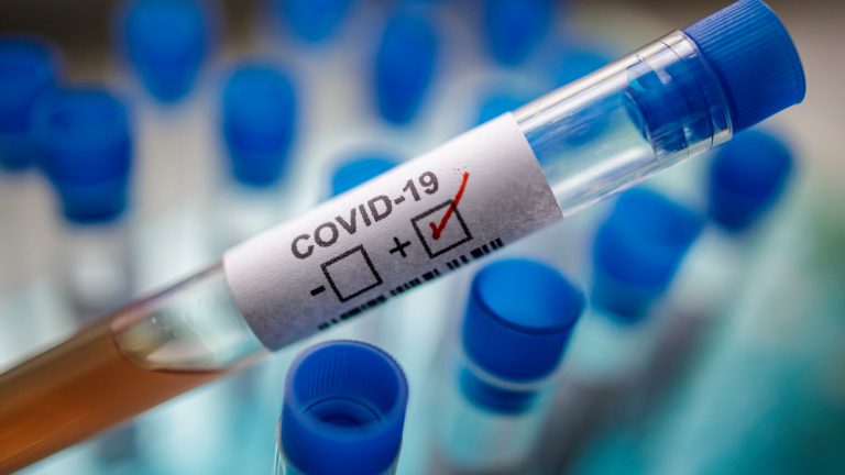 Coronavirus.