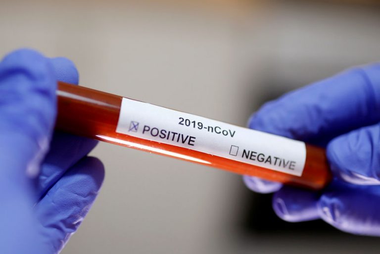 biomerieux-developpe-trois-nouveaux-tests-de